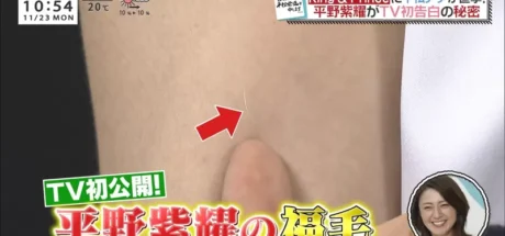 日本网友议论“传说中的宝毛”，身上长出一根白毛真的幸福吗！女高中生为此争论不休！ - 我的世界基岩版中文站