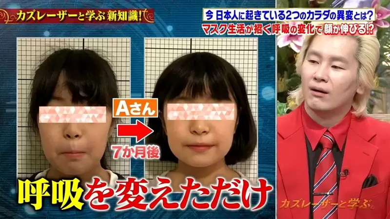 日本牙医分享“疫情戴口罩的意外变化”，习惯用嘴呼吸导致脸部塌陷！跟着医生检查你有没有这种问题！ - 我的世界基岩版中文站 - 我的世界基岩版中文站