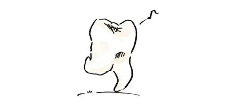 日本网友分享关于“我的智齿太过可爱”这件事，意外成了网络热门话题！吸引了大批网友围观！ - 奇趣星球报