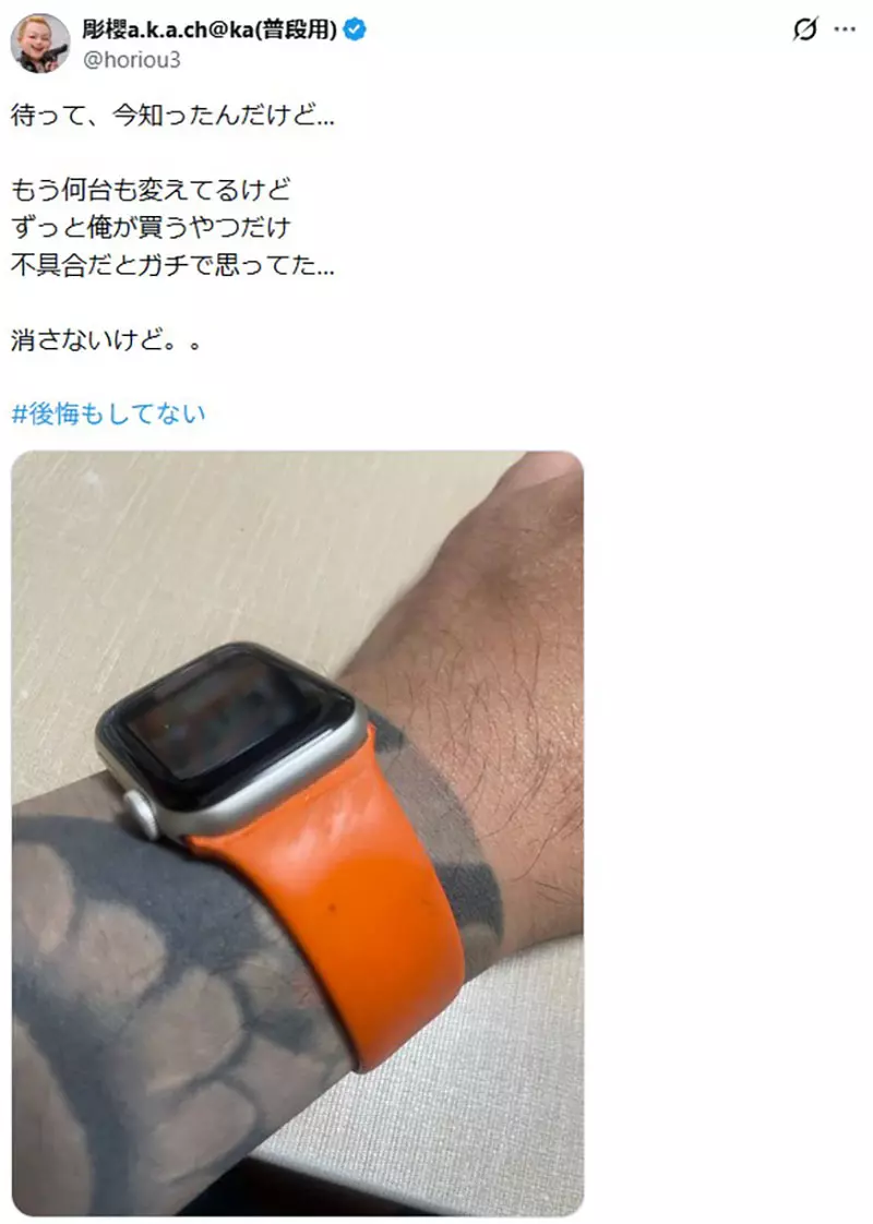 说好一辈子摇滚,日本歌手基里托却想洗文身:Apple Watch 没反应了! 说好一辈子摇滚,日本歌手基里托却想洗文身:Apple Watch 没反应了!